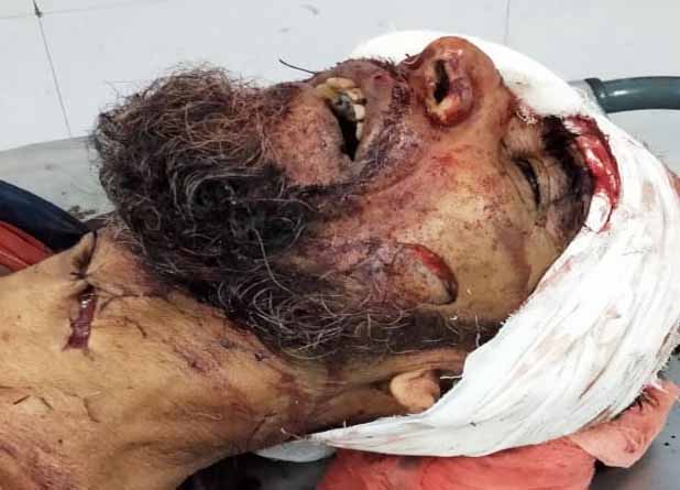 রায়দিঘিতে নৃশংসভাবে কুপিয়ে খুন সিপিআই(এম) সদস্য