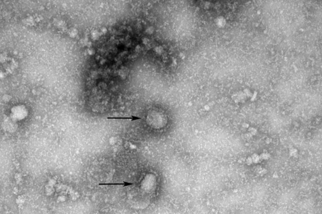 China Posted Corona Virus Image